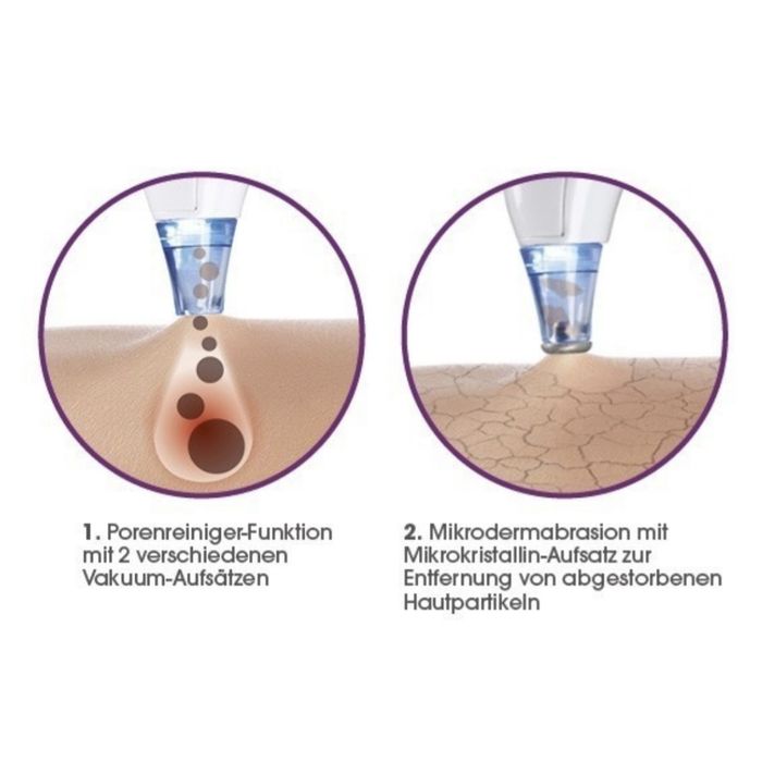 вакуумний очищувач пор VitalMaxx, Німеччина