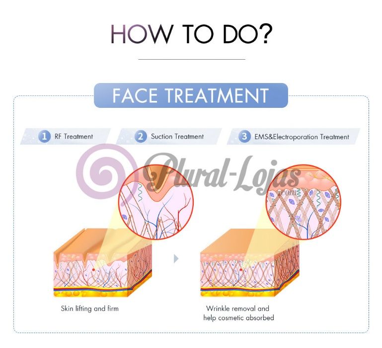 Maquina Cavitação e Radiofrequencia + Vácuo + Ems +Eletroporação