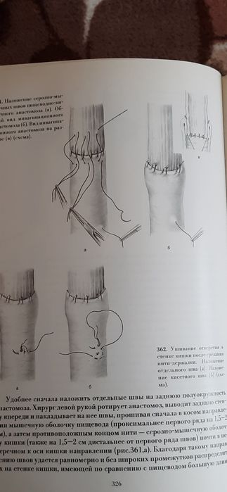 Атлас онкологічних операцій