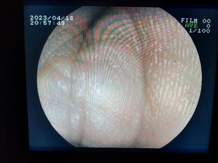 Ендоскоп. Відеогастроскоп. Відеопроцесор. Клавіатура.