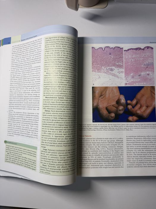 Robbins Pathological Basis of Disease