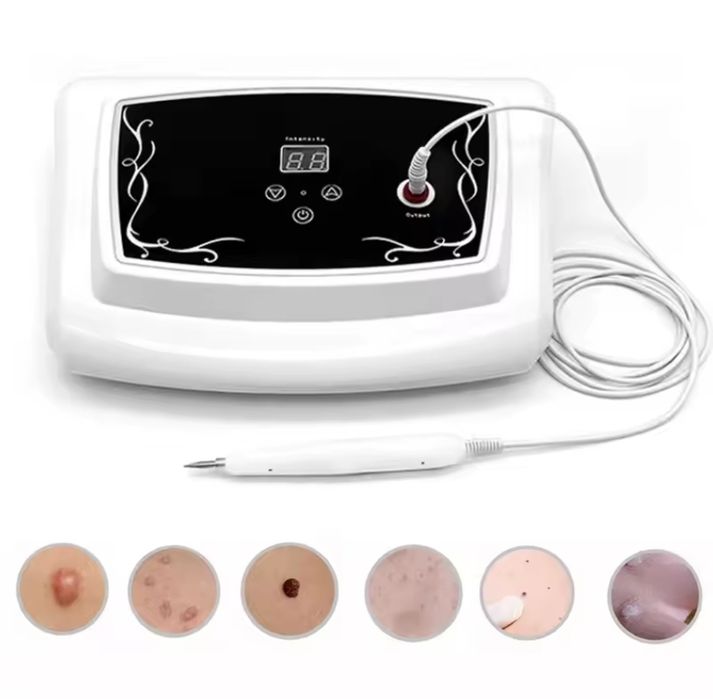 Електрокоагулятор, апарат для видалення папілом