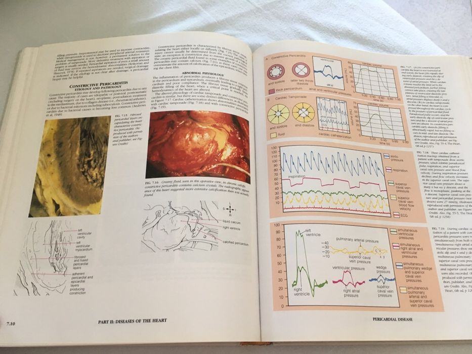 Vendo livro "Atlas of the Heart"