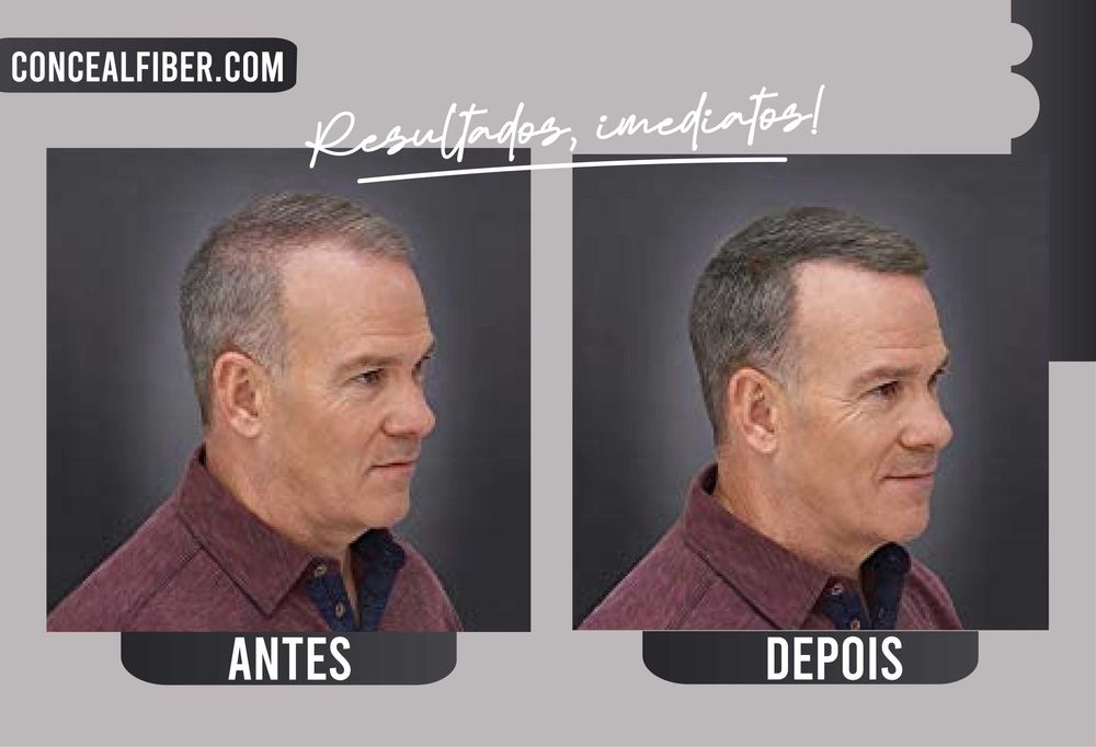 Fibras capilares para Falhas no CABELO - Entrega em mãos a combinar