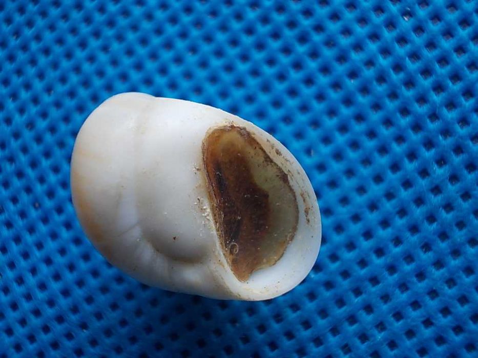 Muszle morskie- Polinices mammilla