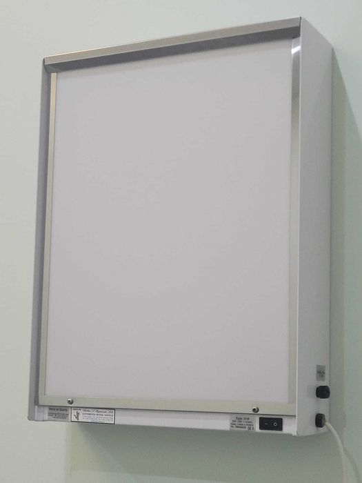 Negatoscópio 1 corpo, em chapa de aço inoxidável como novo