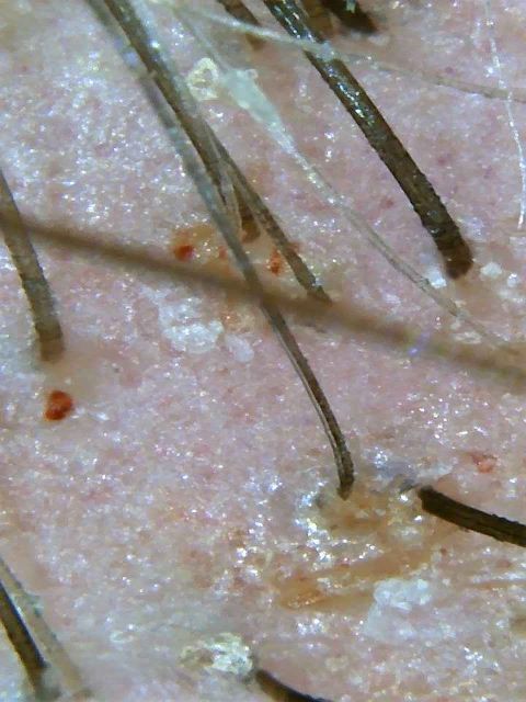 Трихоскоп Микроскоп ДерматоскопWiFi usb для телефона кожи головы волос