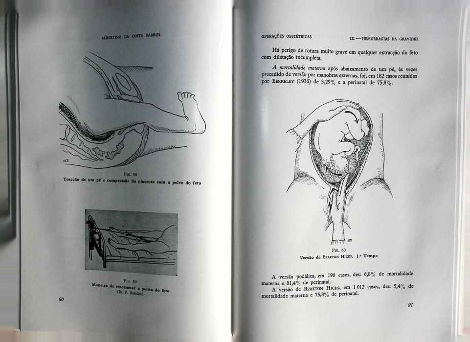 Operações obstétricas I