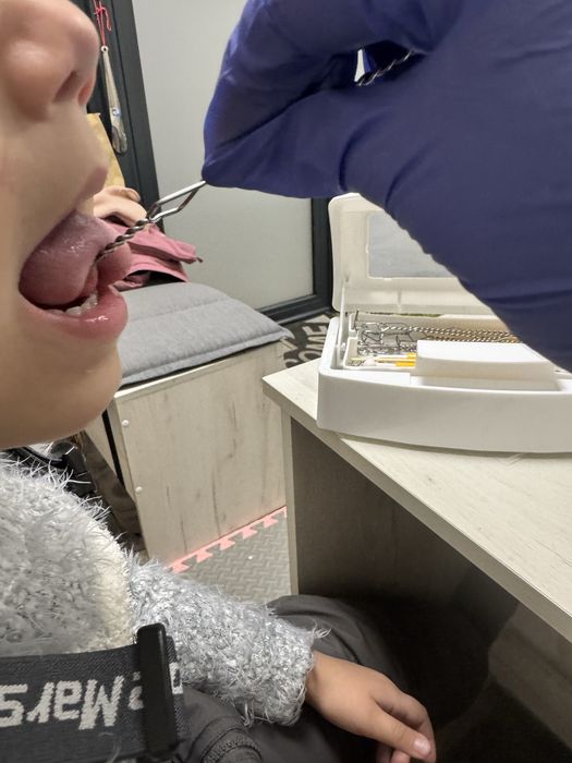 ЛОГОПЕД. Запуск мовлення. Звуки. Речення