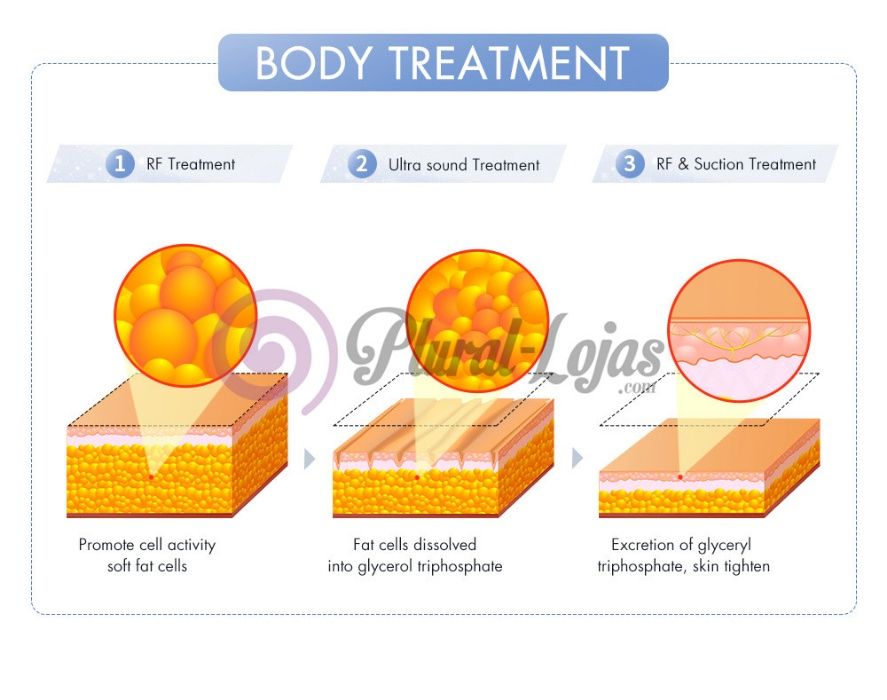 Maquina Cavitação e Radiofrequencia + Vácuo + Ems +Eletroporação