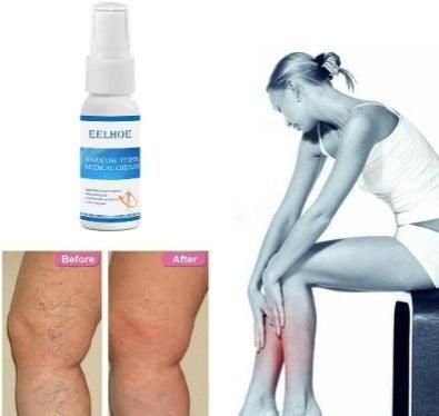 Spray para varizes 30ml