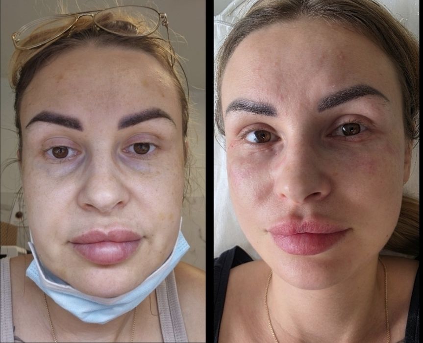 Promocja Borox 1 okolica 130zł