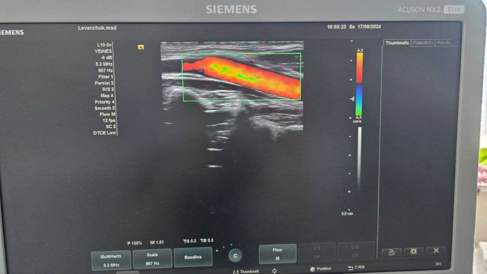 Лінійний датчик УЗД Siemens L10-5V