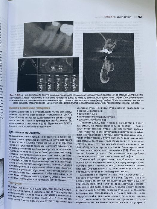 Книга Ендодонтія