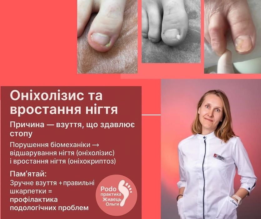 Сучасний подолог