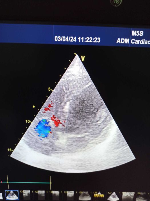 Експертна кардіосистема GE Vivid E9 (2016) M5S-D, 11L-D, 4C-D