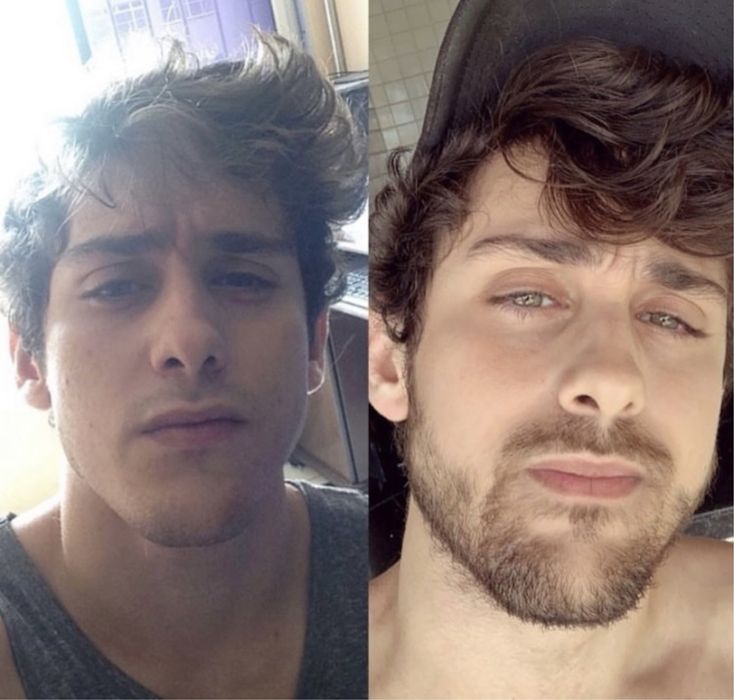 Minoxidil kirkland caixa selada + dermaroler