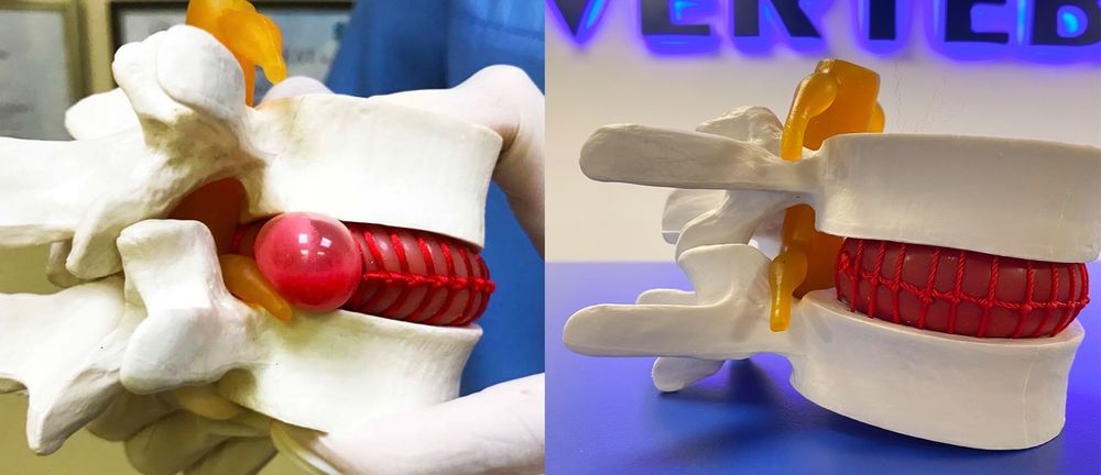 Здоровий спосіб життя -це добре масаж допоможе