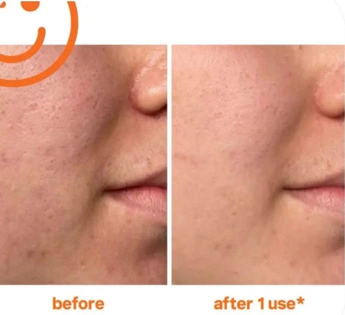 Маска-ексфоліант для ідеально чистої шкіри Kate Somerville Exfolikate