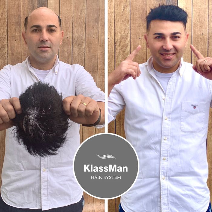 Nova Clinica KlassMan Lisboa Metro-Telheiras 1m. Porto Metro-Dragão 1m