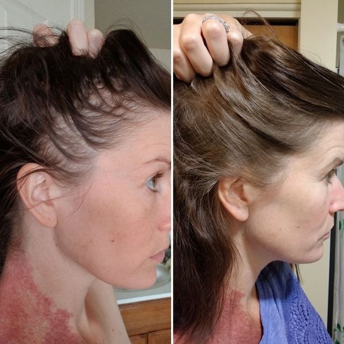Tratamento natural " PELE E CABELO "
