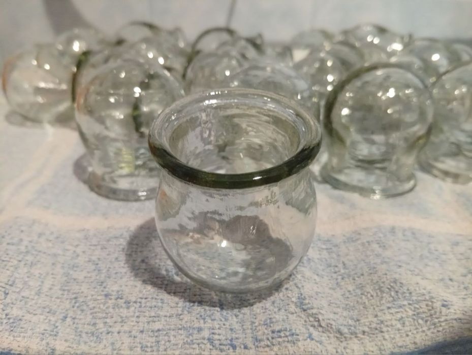 Медичні вакуумні банки