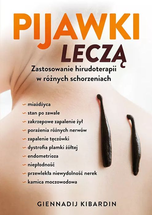 Pijawki Leczą. Zastosowanie Hirudoterapii W Różnych Schorzeniach. Nowy Produkt