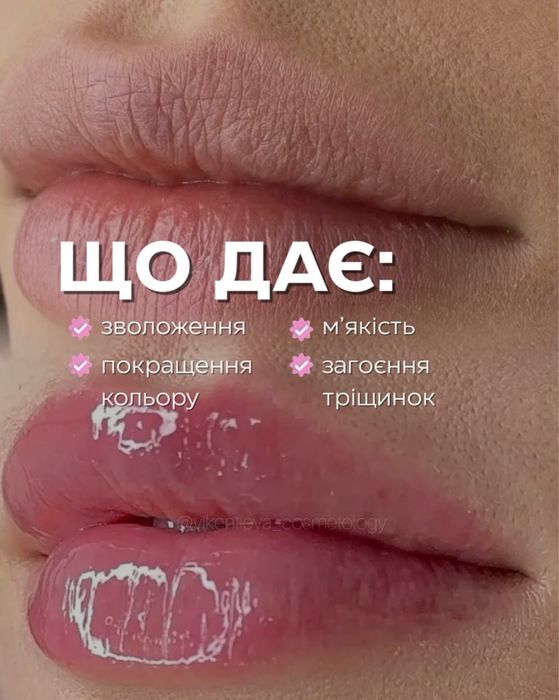 Мікронідлінг губ HYDRA LIPS - Безінʼєкційне зволоження!