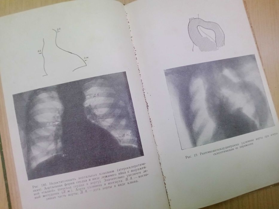 Хвороби серцево-судинної системи в середньому та літн. віці. В.Зеленин