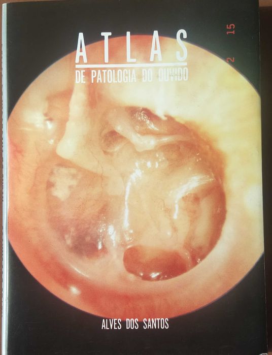 Atlas de Patologia do Ouvido
