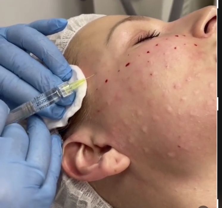 Косметология,. Массаж. Днепр.  пр. Слобожанский