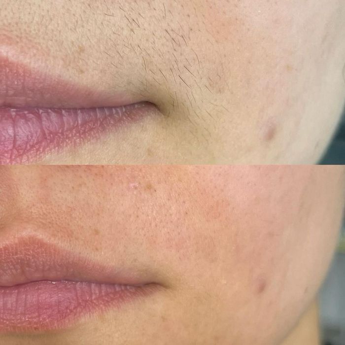 Шугаринг та депіляція воском. м.Запоріжжя, Хортицький район