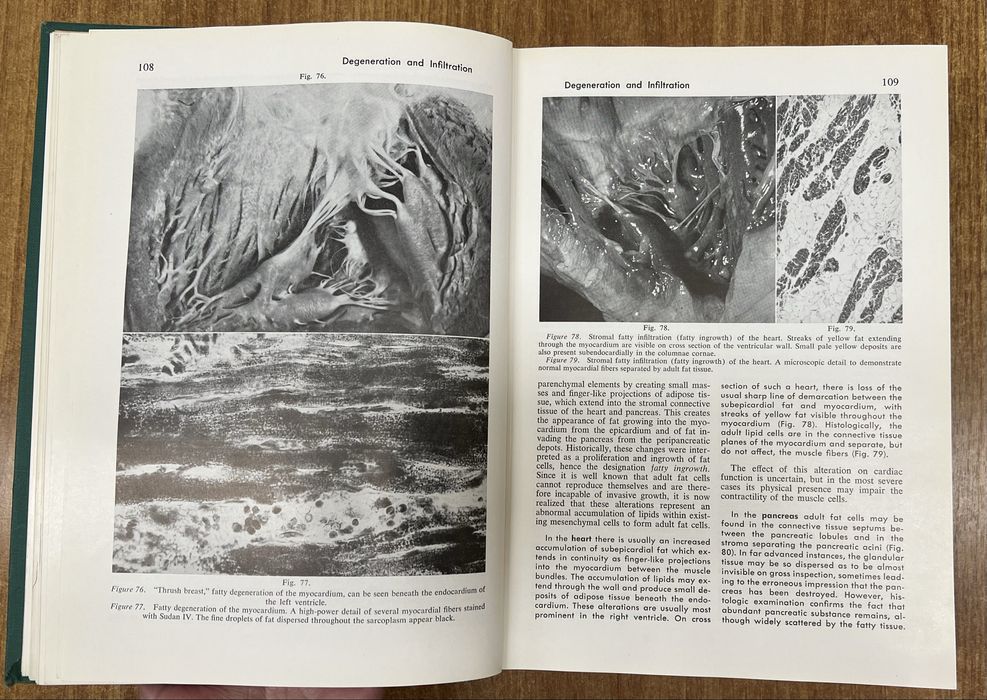 «Textbook of Pathology» Stanley L. Robbins, 1st Ed. «Патологія»