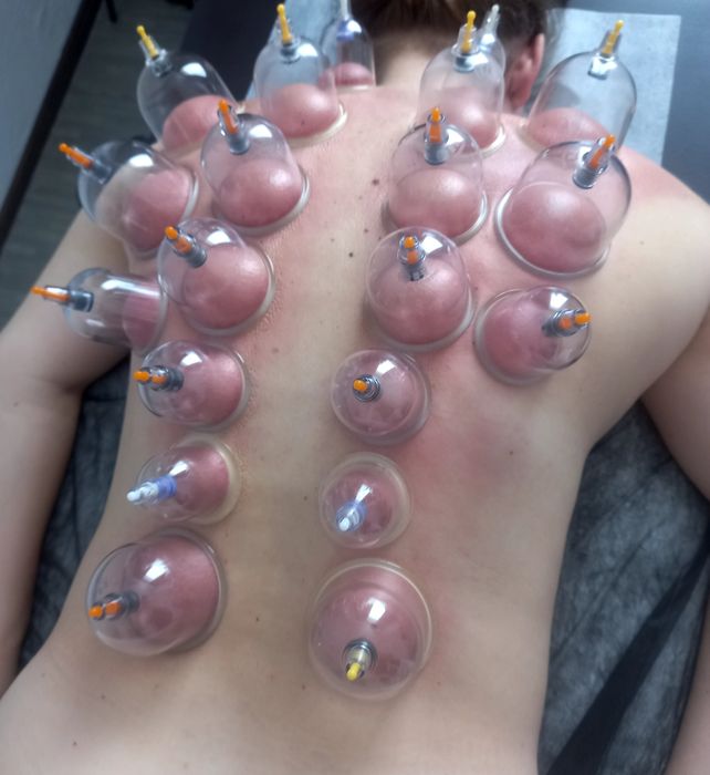 Масаж лікувальний