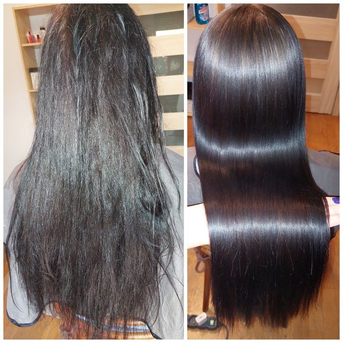 Keratynowe prostowanie, Krioterapia, NANOPLASTIA, Botox