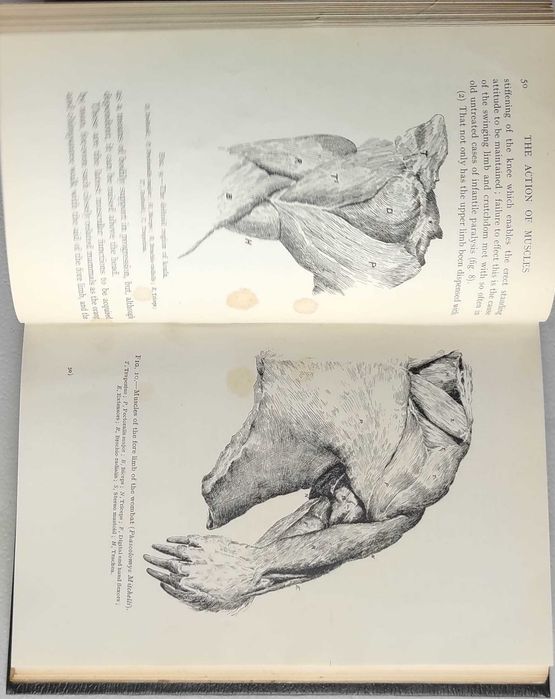 Livro Ref Par 2- The Action of Muscles - William Colin Mackenzie