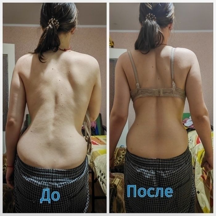 Костоправ ,устранение болей в спине