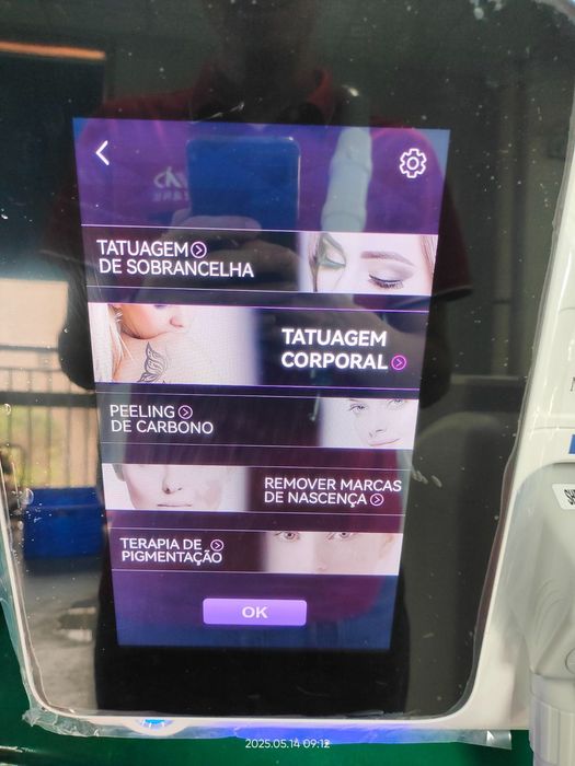 Máquina de remoção de tatuagem a laser