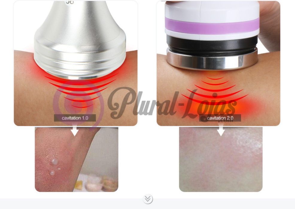 Cavitação Portátil Nova Tecnologia Unoisetion 40k - 2.0 A