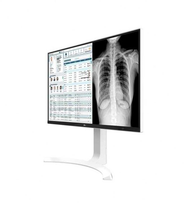 LG monitor 27 branco