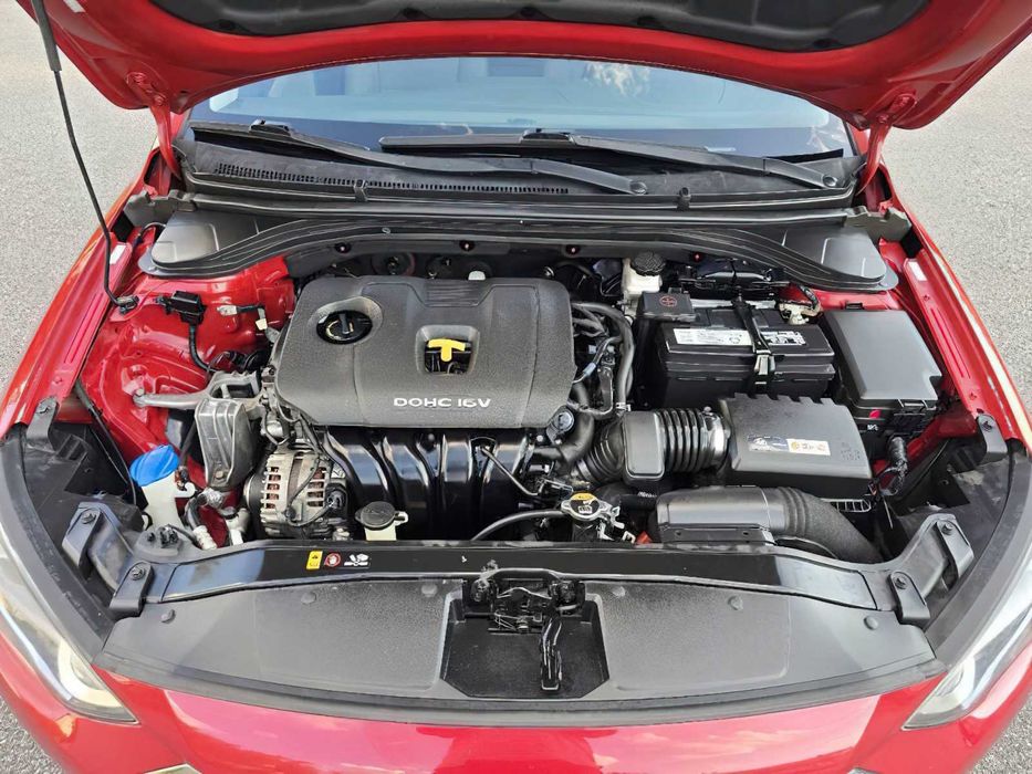 Hyundai Elantra      2017
