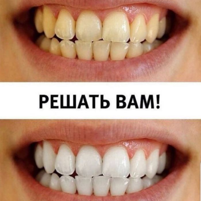 Косметичний бізнес / Франшиза відбілювання зубів Smile LAB