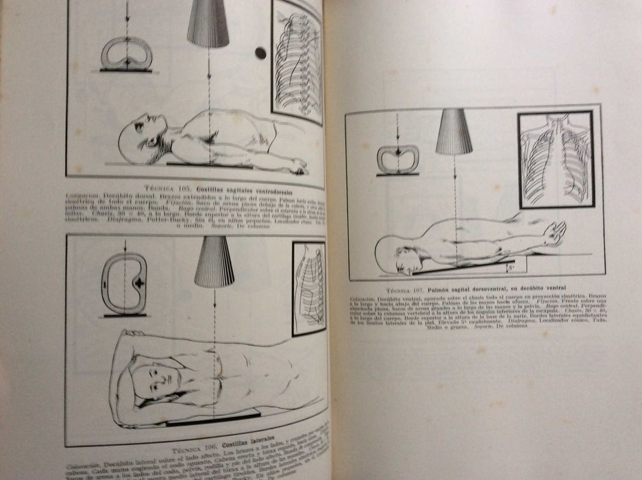 Técnica de la exploración roentgenoscópica y roentgenográfica , 1944
