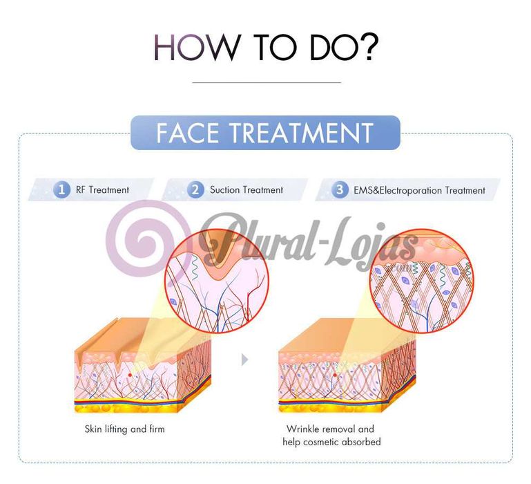 Maquina Cavitação S SHAPER +Radiofrequencia + Vácuo + Mesoterapia