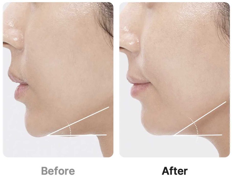 [Medicube] Age-R Booster Pro purple