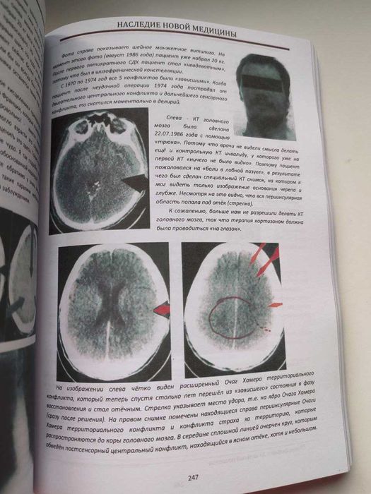 Наследие новой медицины 2 тома+карта ГНМ в подарок