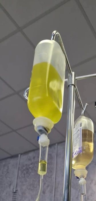 Kroplówki, DETOX po alkoholu i innych, witaminowe i wzmacniające.