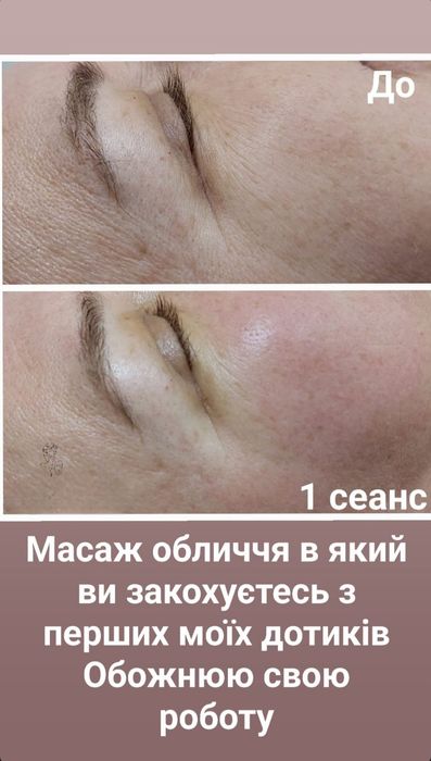 Масаж обличчя комплексний , Ірпінь 7 Лінія