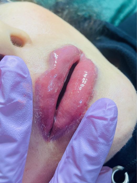 Ищу девочек которые хотят сочные губки !Оплата только за препарат !