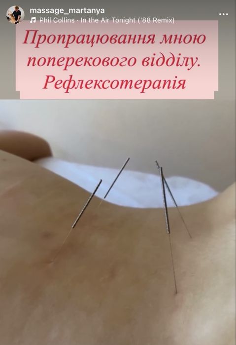 Реабілітація,мануальна вертебрологія, масаж м.Сміла